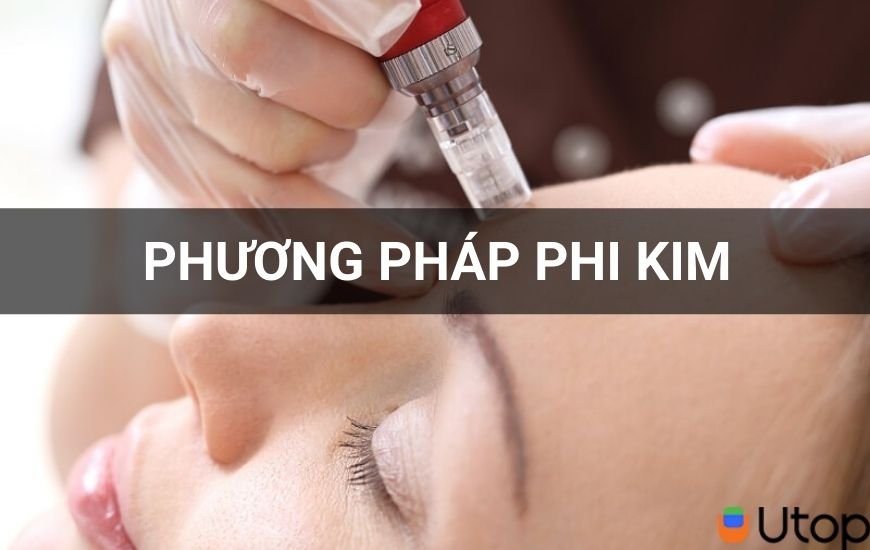 Phương pháp phi kim là gì?